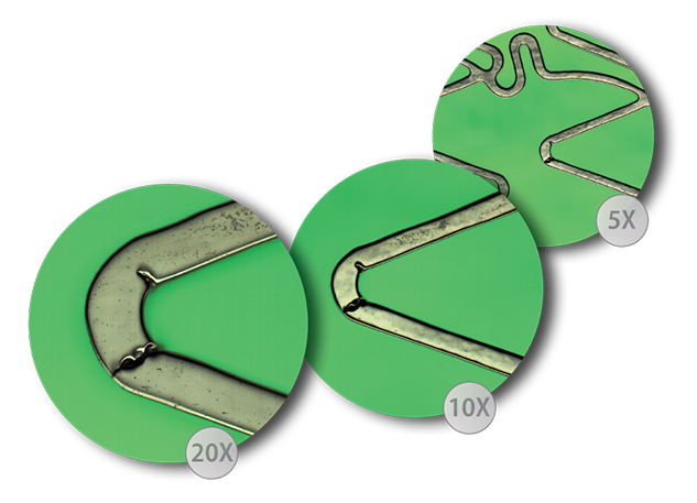 Stent defect inspection Q six