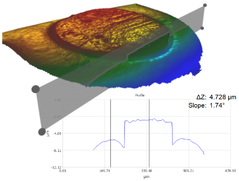 Stent Markers in 3D