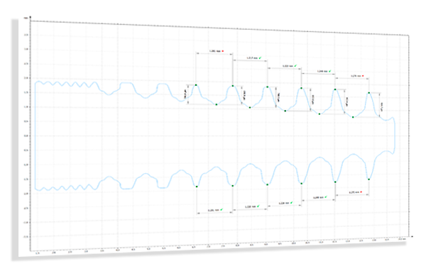 Threads on dental implants graph