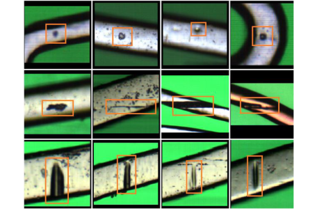 Automated stent defect detection and classification with a high numerical aperture optical system