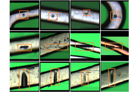 Automated stent defect detection and classification with a high numerical aperture optical system