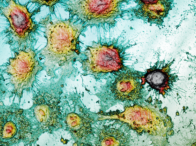 Morphological surface analysis to study cell viability