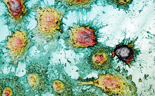 Morphological surface analysis to study cell viability