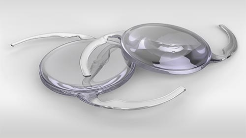 Intraocular lens implant