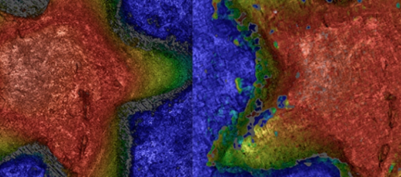 Single-shot optical surface profiling using extended depth of field 3D microscopy